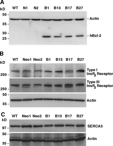 positive elisa negative western blot